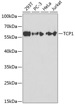 Western blot - TCP1 Polyclonal Antibody 