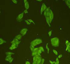 Fig2: ICC staining GAP43 in Hela cells (green). Cells were fixed in paraformaldehyde, permeabilised with 0.25% Triton X100/PBS.