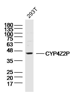Fig1: Sample:293T (Human)Cell Lysate at 40 ug; Primary: Anti-CYP4Z2P at 1/300 dilution; Secondary: IRDye800CW Goat Anti-RabbitIgG at 1/20000 dilution; Predicted band size: 40kD; Observed band size: 40kD