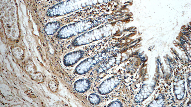 Immunohistochemistry of paraffin-embedded human colon tissue slide using Catalog No:109108(CDC42SE2 Antibody) at dilution of 1:50 (under 10x lens)