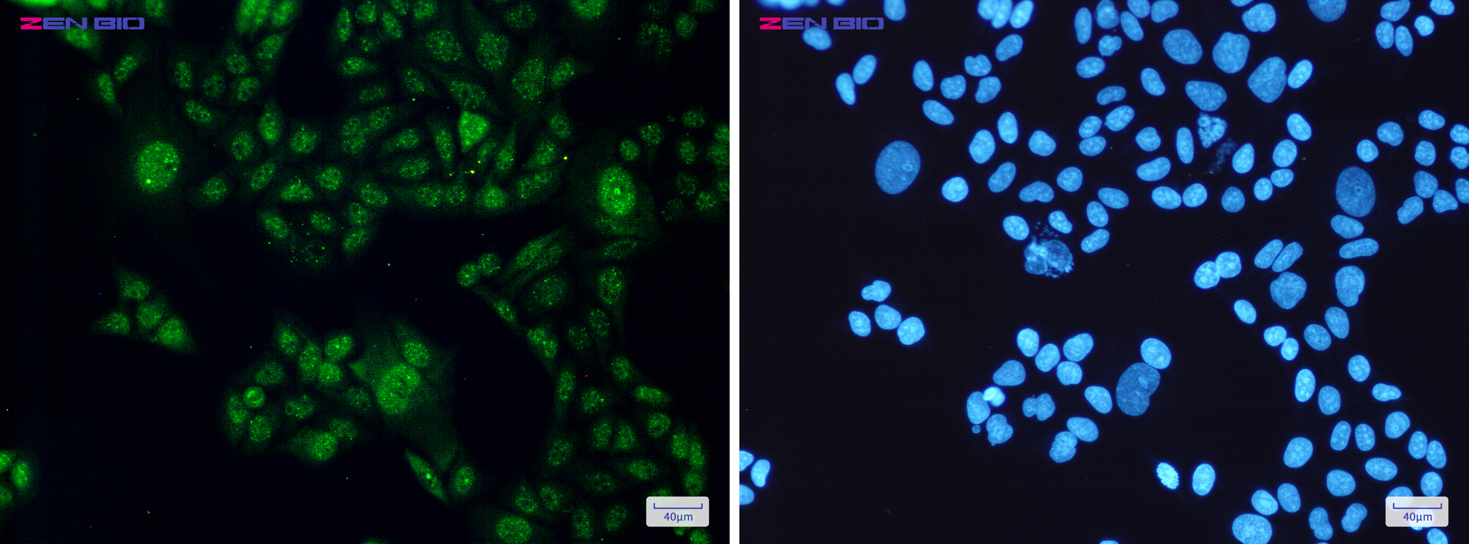 Immunocytochemistry of STAT3(green) in Hela cells using STAT3 Rabbit mAb at dilution 1/200, and DAPI(blue)