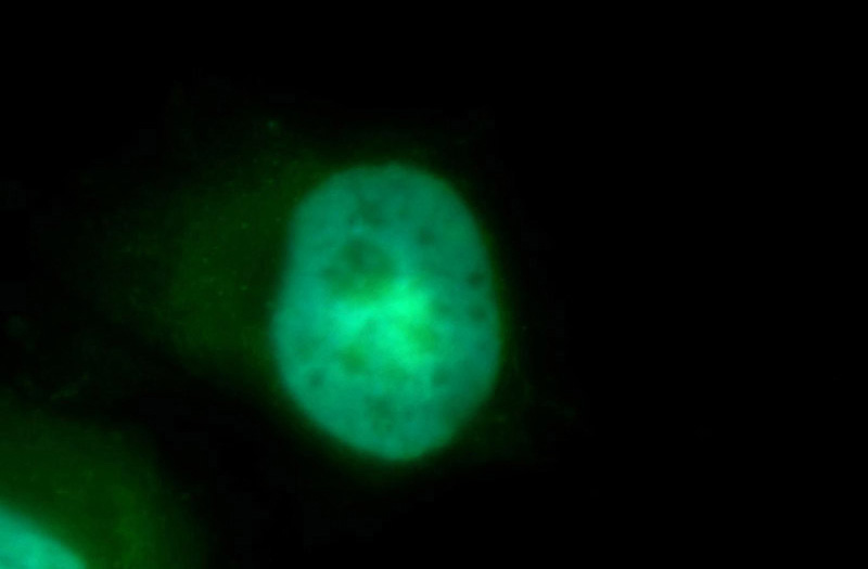 Immunofluorescent analysis of MCF-7 cells, using CDK4 antibody Catalog No:109161 at 1:50 dilution and FITC-labeled donkey anti-rabbit IgG(green). Blue pseudocolor = DAPI (fluorescent DNA dye)