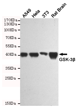 Western blot analysis of extracts from A549, Hela, 3T3 and Rat Brain cell lysates using GSK-3 beta mouse mAb(1:1000 diluted).Predicted band size:46KDa.Observed band size:46KDa.