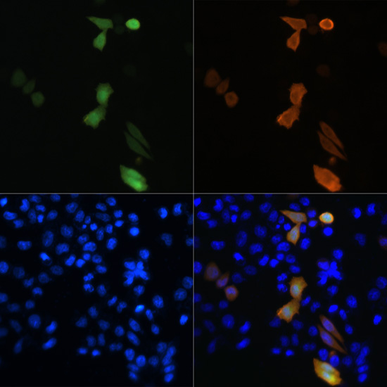 Immunofluorescence - Rabbit anti DDDDK-Tag mAb 