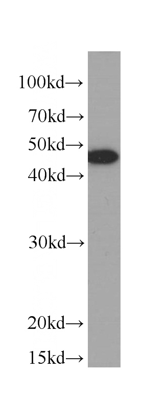 MCF-7 cells were subjected to SDS PAGE followed by western blot with Catalog No:107232(KRT19 Antibody) at dilution of 1:1500