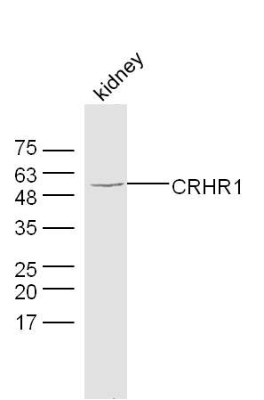 Fig2: Sample: kidney (mouse) Lysate at 40 ug; Primary: Anti-CRHR1 at 1/300 dilution; Secondary: IRDye800CW Goat Anti-Rabbit IgG at 1/20000 dilution; Predicted band size: 48 kD; Observed band size: 58 kD