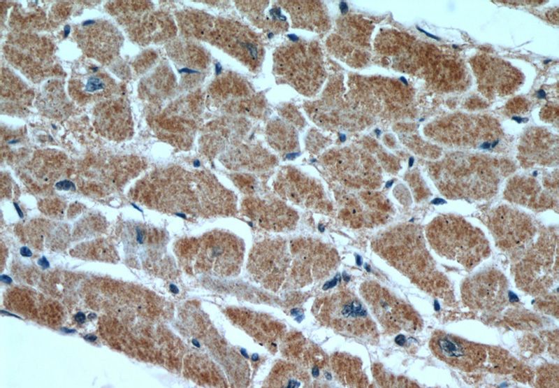 Immunohistochemical of paraffin-embedded human heart using Catalog No:111470(HS3ST1 antibody) at dilution of 1:50 (under 40x lens)