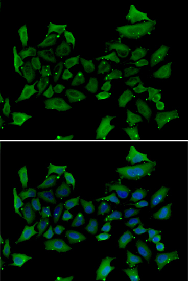 Immunofluorescence - ALAS1 Polyclonal Antibody 