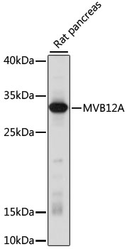 Western blot - MVB12A Polyclonal Antibody 