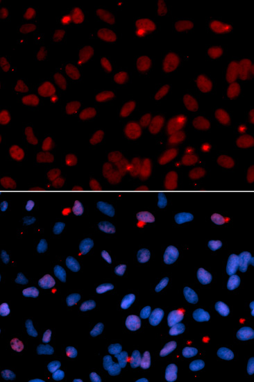 Immunofluorescence - SRSF1 Polyclonal Antibody 