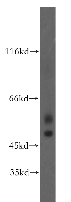 human brain tissue were subjected to SDS PAGE followed by western blot with Catalog No:110808(GABRA3 antibody) at dilution of 1:100