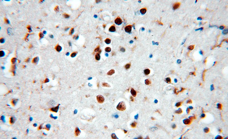 Immunohistochemical of paraffin-embedded human brain using Catalog No:115463(SNRPE antibody) at dilution of 1:50 (under 40x lens)