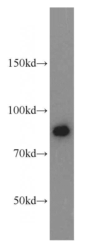 MCF7 cells were subjected to SDS PAGE followed by western blot with Catalog No:108327(ATRIP antibody) at dilution of 1:1000