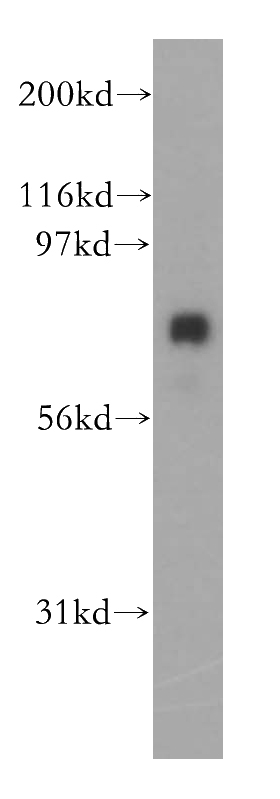 HeLa cells were subjected to SDS PAGE followed by western blot with Catalog No:109371(COG8 antibody) at dilution of 1:400