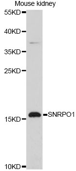 Western blot - SNRPD1 Polyclonal Antibody 