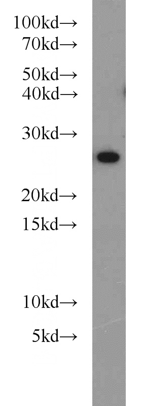 MCF7 cells were subjected to SDS PAGE followed by western blot with Catalog No:113722(Prx III antibody) at dilution of 1:400
