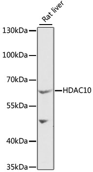 Western blot - HDAC10 Polyclonal Antibody 