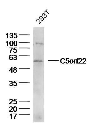 Fig2: Sample:293T(huamn) Cell Lysate at 40 ug; Primary: Anti-C5orf22 at 1/300 dilution; Secondary: IRDye800CW Goat Anti-Rabbit IgG at 1/20000 dilution; Predicted band size: 50kD; Observed band size: 55kD