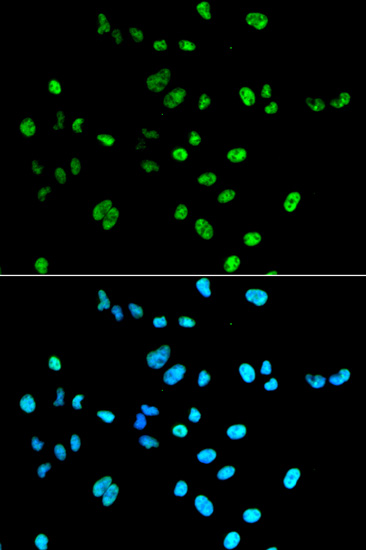 Immunofluorescence - PAX2 Polyclonal Antibody 