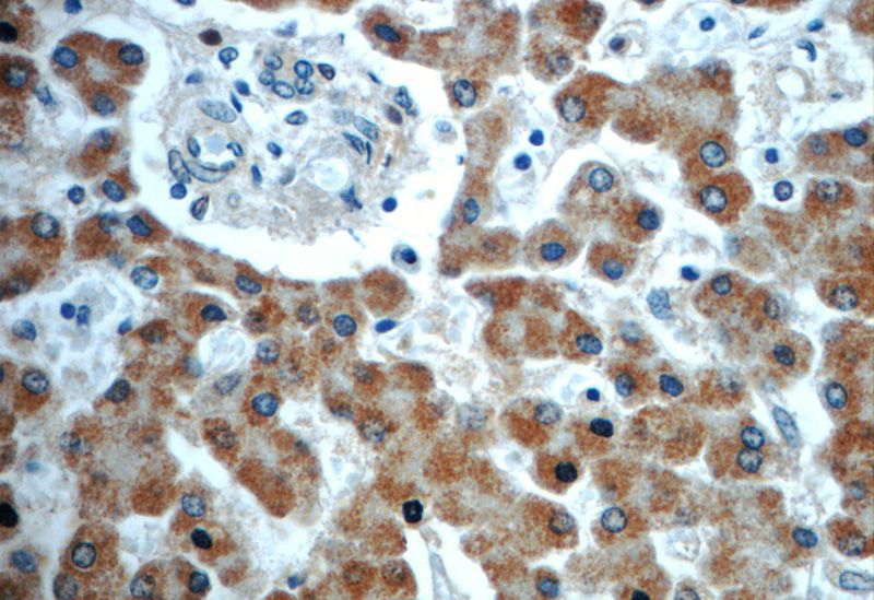 Immunohistochemistry of paraffin-embedded human liver slide using Catalog No:116134(TIMM50 Antibody) at dilution of 1:50