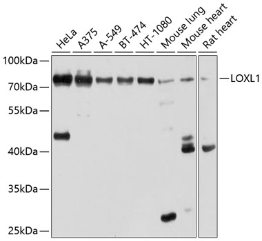 Western blot - LOXL1 Polyclonal Antibody 