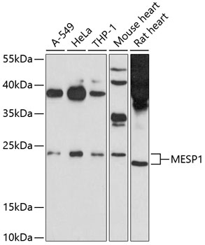 Western blot - MESP1 Polyclonal Antibody 