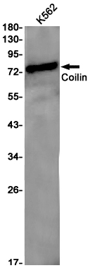 Western blot detection of Coilin in K562 cell lysates using Coilin Rabbit pAb(1:1000 diluted).Predicted band size:63kDa.Observed band size:80kDa.