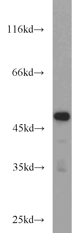 mouse lung tissue were subjected to SDS PAGE followed by western blot with Catalog No:110805(GABPB1 antibody) at dilution of 1:1000