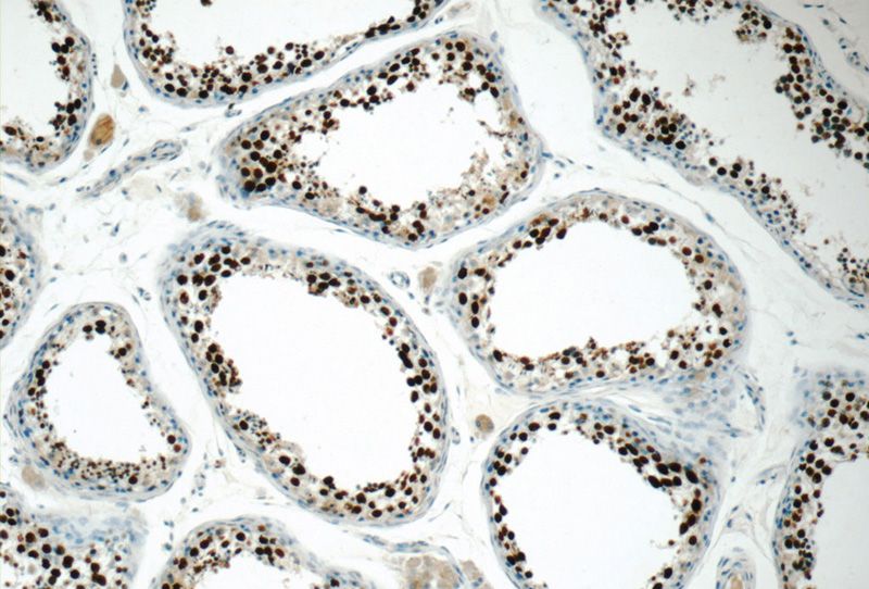 Immunohistochemistry of paraffin-embedded human testis tissue slide using Catalog No:117075(AUTS2 Antibody) at dilution of 1:50 (under 10x lens)
