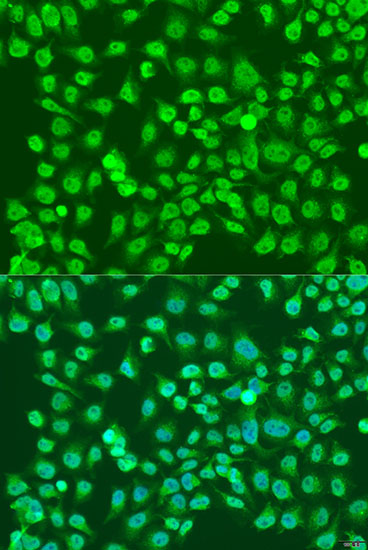 Immunofluorescence - NPR3 Polyclonal Antibody 