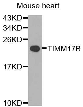 Western blot - TIMM17B Polyclonal Antibody 
