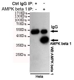 Immunoprecipitation analysis of Hela cell lysates using AMPK beta 1 mouse mAb.