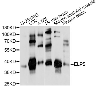 Western blot - ELP5 Polyclonal Antibody 