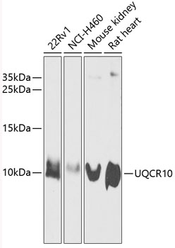 Western blot - UQCR10 Polyclonal Antibody 