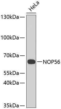 Western blot - NOP56 Polyclonal Antibody 