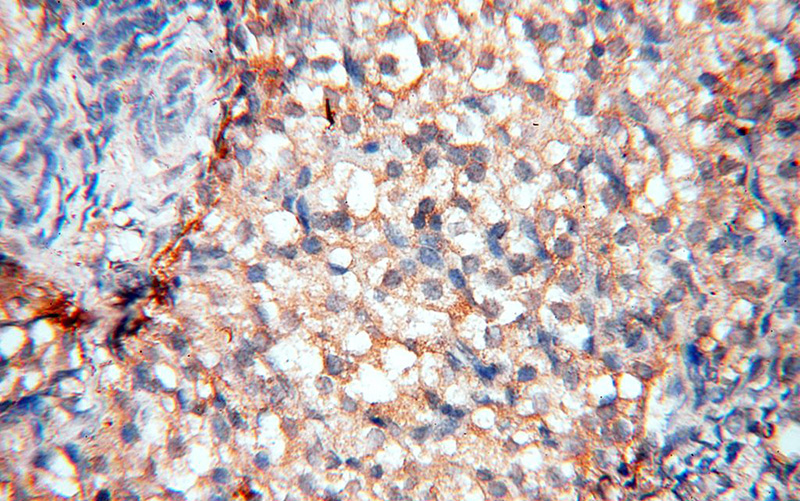 Immunohistochemical of paraffin-embedded human ovary using Catalog No:114129(PPIL3 antibody) at dilution of 1:50 (under 40x lens)