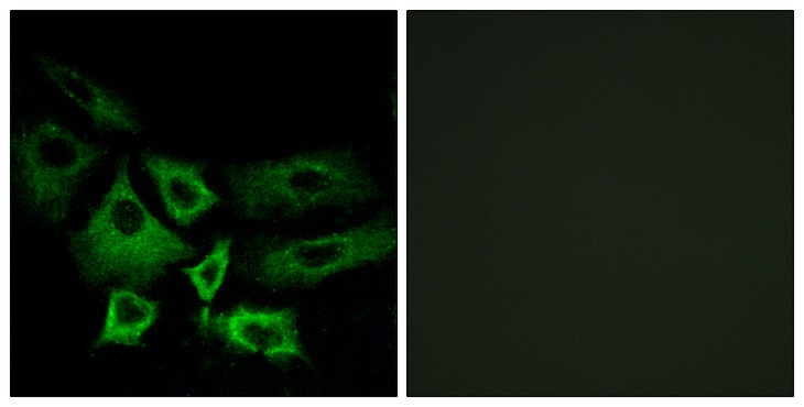 Fig2:; Immunofluorescence analysis of A549 cells, using NT5C1A Antibody. The picture on the right is blocked with the synthesized peptide.