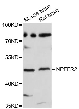 Western blot - NPFFR2 Polyclonal Antibody 