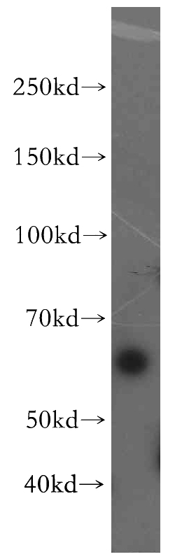 HepG2 cells were subjected to SDS PAGE followed by western blot with Catalog No:112348(LSM14A antibody) at dilution of 1:500