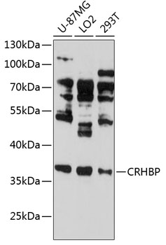 Western blot - CRHBP Polyclonal Antibody 