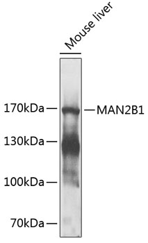Western blot - MAN2B1 Polyclonal Antibody 