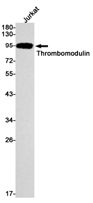 Western blot detection of Thrombomodulin in Jurkat cell lysates using Thrombomodulin Rabbit mAb(1:1000 diluted).Predicted band size:60kDa.Observed band size:95kDa.