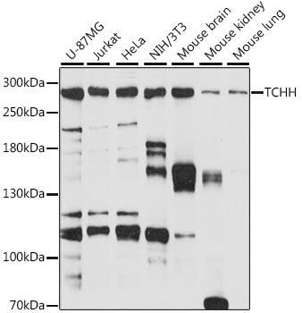 Western blot - TCHH Polyclonal Antibody 