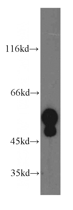 A431 cells were subjected to SDS PAGE followed by western blot with Catalog No:109790(KRT13 antibody) at dilution of 1:1000