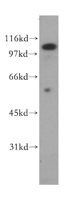human liver tissue were subjected to SDS PAGE followed by western blot with Catalog No:114371(FOLH1 antibody) at dilution of 1:500