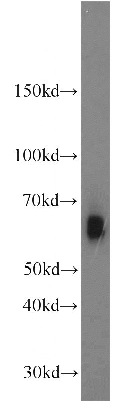 K-562 cells were subjected to SDS PAGE followed by western blot with Catalog No:110946(GFI1 antibody) at dilution of 1:500