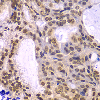 Immunohistochemistry - POLD3 Polyclonal Antibody 