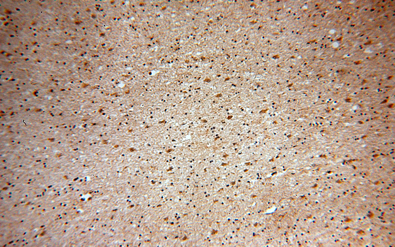 Immunohistochemical of paraffin-embedded human brain using Catalog No:111450(HPRT1 antibody) at dilution of 1:100 (under 10x lens)