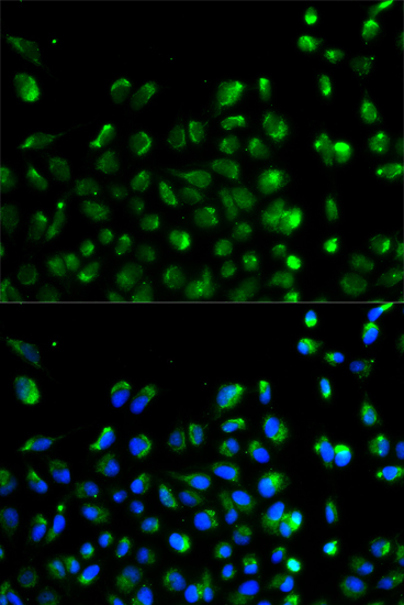 Immunofluorescence - ATG13 Polyclonal Antibody 
