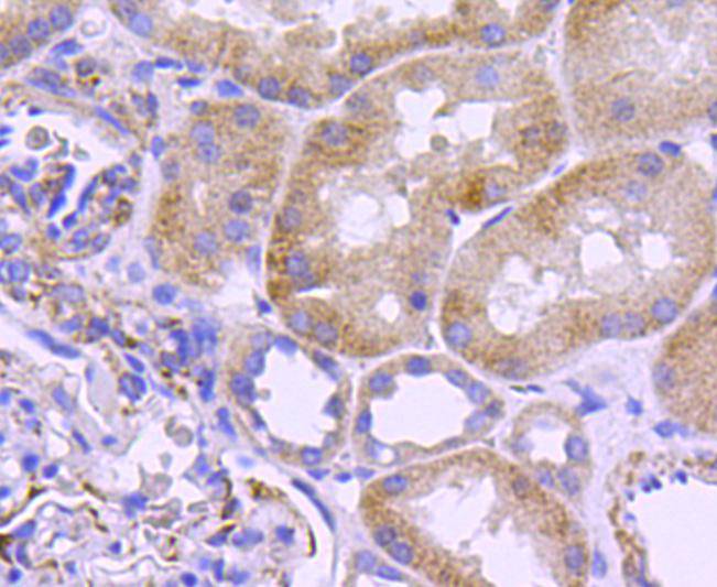 Fig1: Immunohistochemical analysis of paraffin-embedded human kidney tissue using anti-Filamin A antibody. Counter stained with hematoxylin.
